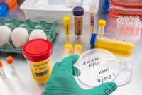 A photo of a gloved hand holding a petri dish testing for avian flu.